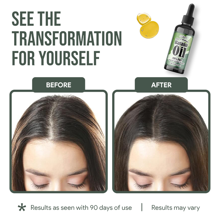 Natural 60ML Batana Oil,oalen cosmetics