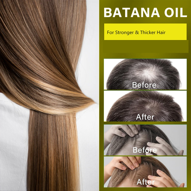 Natural Batana Oil For Hair,oalen cosmetics