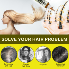 Natural Batana Oil For Hair,oalen cosmetics