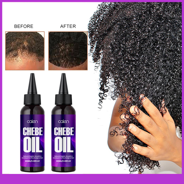 100ML Chebe Oil,oalen cosmetics