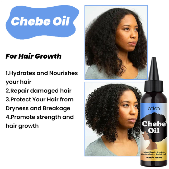 Nourishing Dry Scalp Chebe Hair Growth Oil,oalen cosmetics