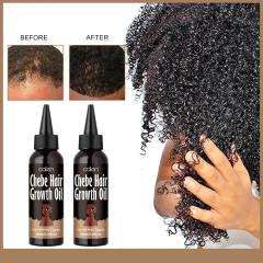Rapid Hair Growth Oil Hair Loss Treatment Chebe Hair Oil For Hair,oalen cosmetics