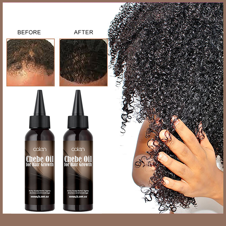 Ant-Hair loss Chebe Hair Oil,oalen cosmetics