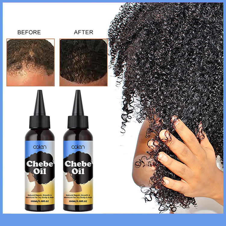 Nourishing Dry Scalp Chebe Hair Growth Oil,oalen cosmetics