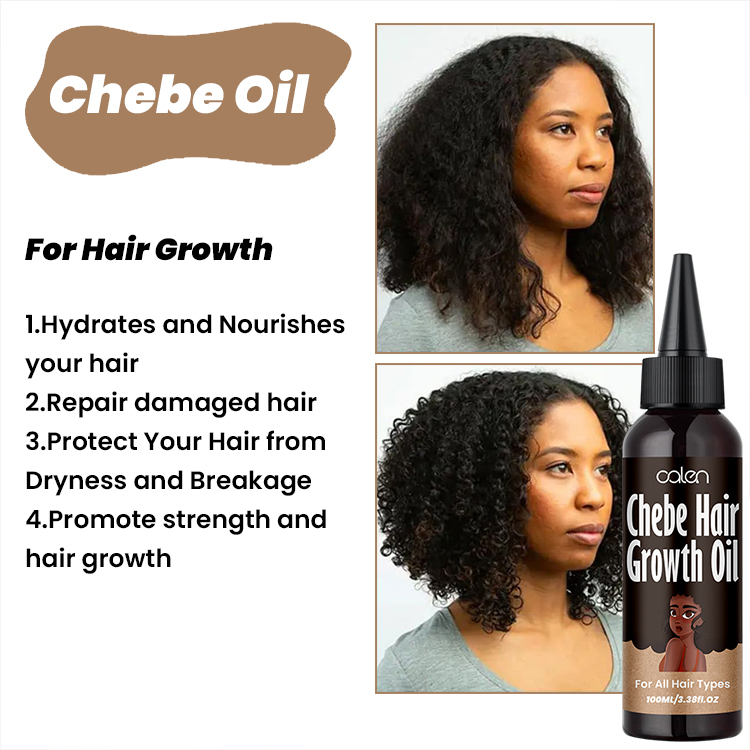Rapid Hair Growth Oil Hair Loss Treatment Chebe Hair Oil For Hair,oalen cosmetics