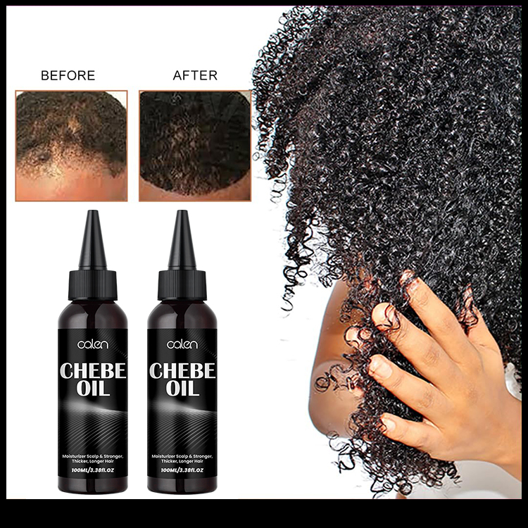 Hair Growth Chebe Hair Oil Ant-Hair Loss,oalen cosmetics