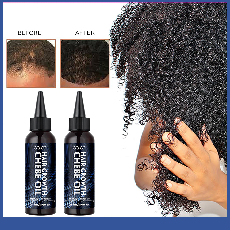 Reduces Hair Loss 100ML Hair Growth Oil Chebe,oalen cosmetics