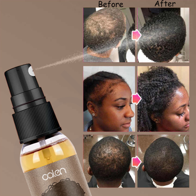 Chebe Scalp Repair Spray,oalen cosmetics