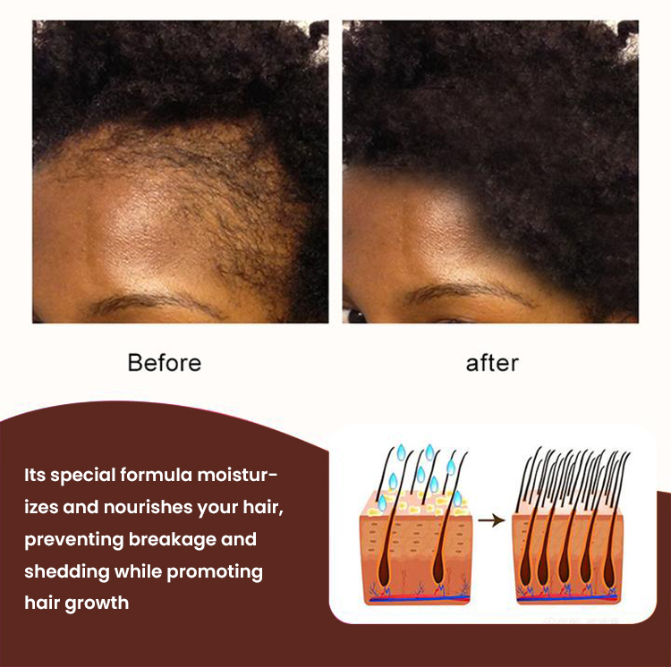 Customs Logo Chebe Hair Growth Butter,oalen cosmetics
