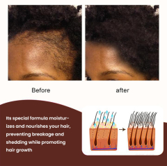 Customs Logo Chebe Hair Growth Butter,oalen cosmetics
