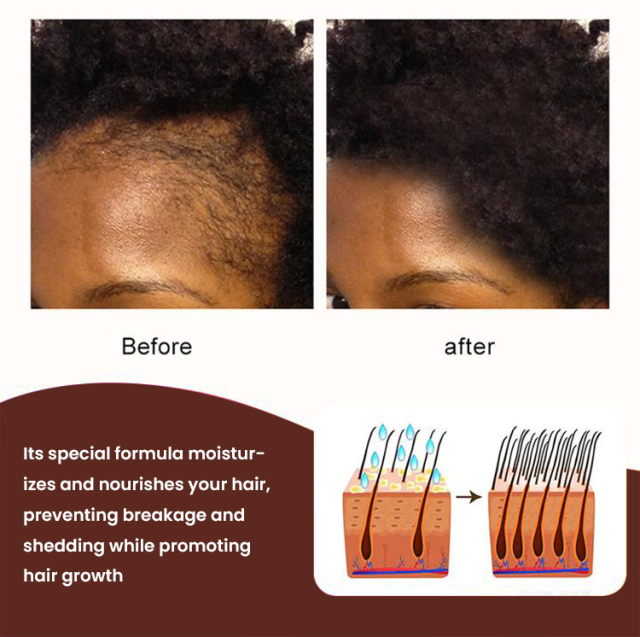 Customs Logo Chebe Hair Growth Butter,oalen cosmetics