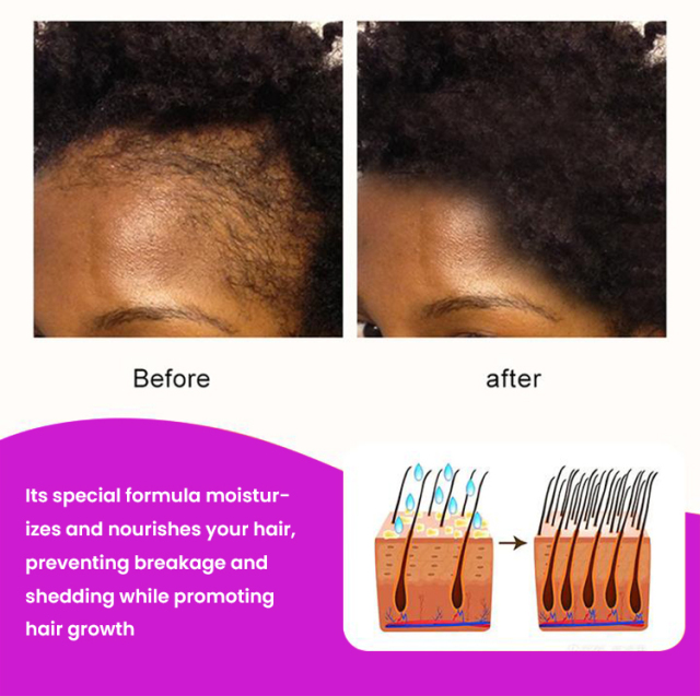Chebe Hair Growth Butter 102G,oalen cosmetics
