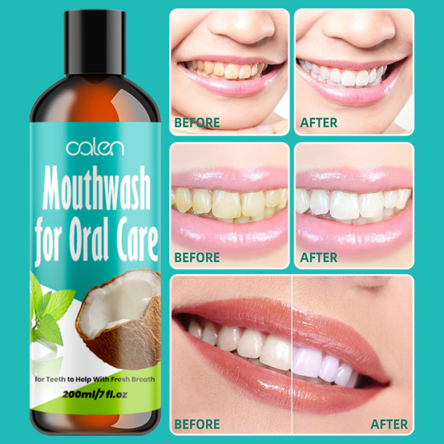 Oral Gum Health Coconut Pulling Oil,oalen cosmetics