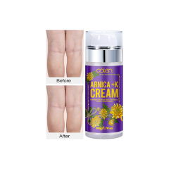 OEM Pain Relief Cream Unsightly Veins,oalen cosmetics