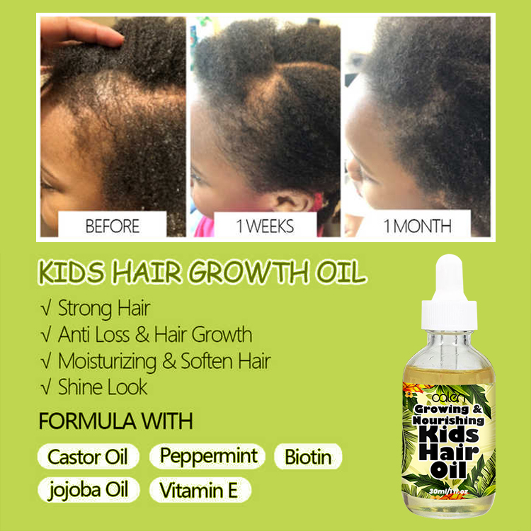 Organic Pineapple Hair Growth Oil For Kids,oalen cosmetics