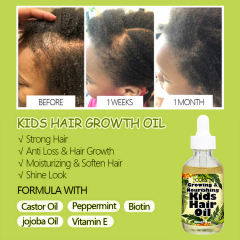 Organic Pineapple Hair Growth Oil For Kids,oalen cosmetics