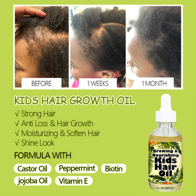 Organic Pineapple Hair Growth Oil For Kids,oalen cosmetics