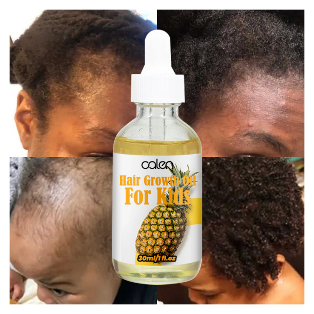 30ML Baby Kids Hair Oil,oalen cosmetics