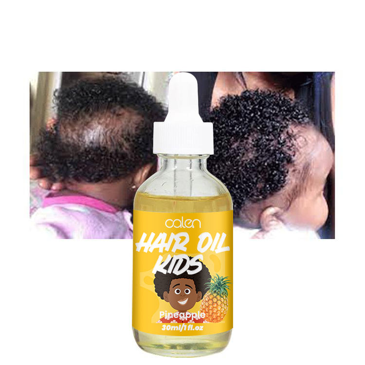 Kids Hair Oil For Girls and Boys,oalen cosmetics