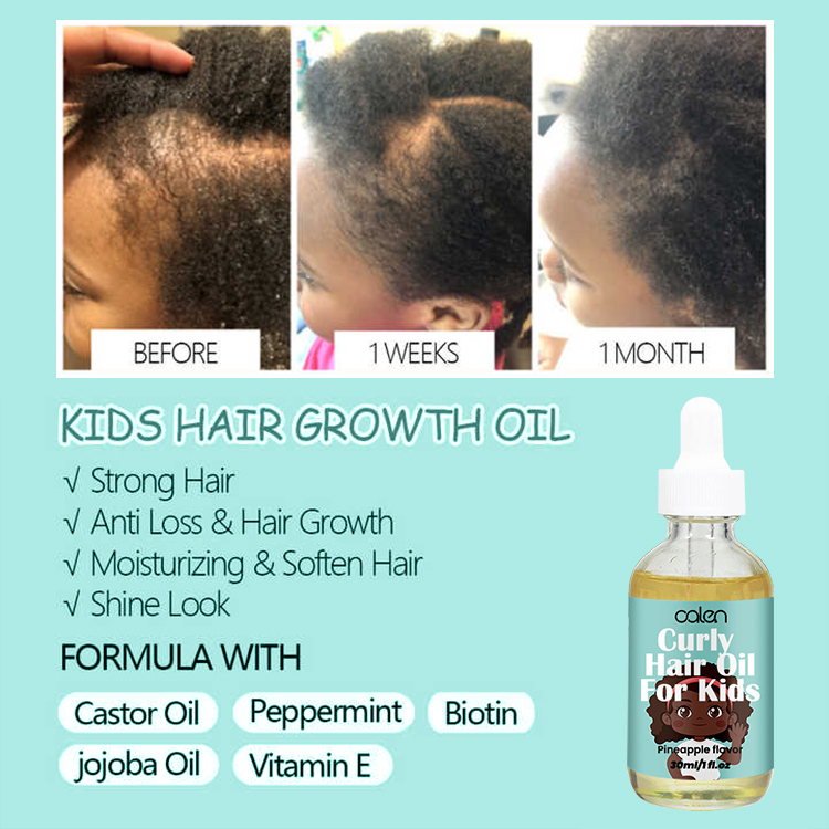 Nourishment 30ML Hair Oil For Kids,oalen cosmetics