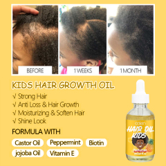 Kids Hair Oil For Girls and Boys,oalen cosmetics