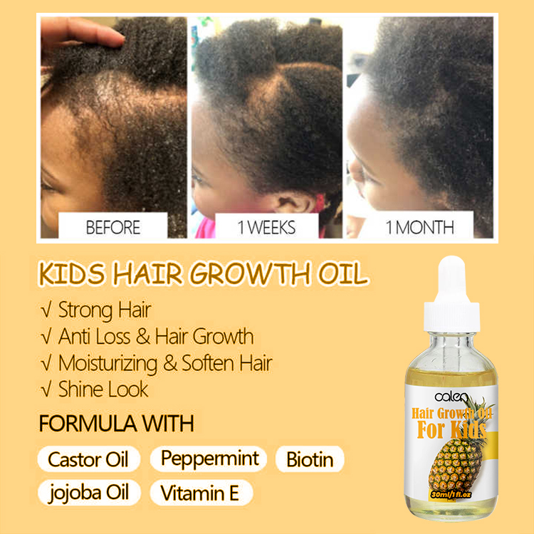 30ML Baby Kids Hair Oil,oalen cosmetics