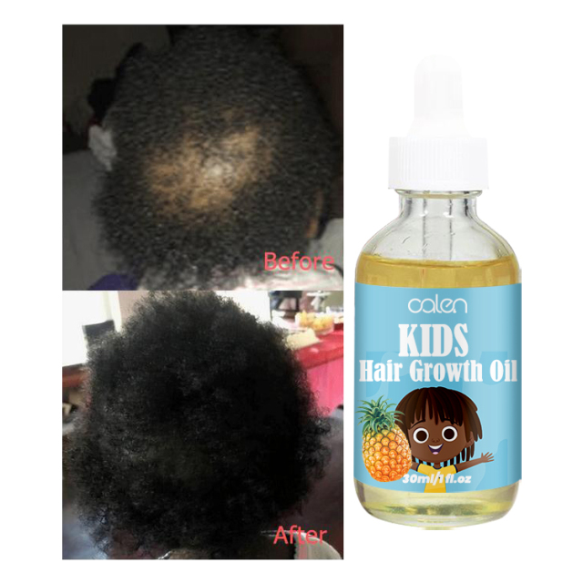 Children Hair Growth Oil,oalen cosmetics