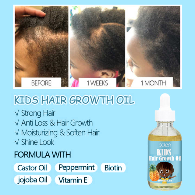 Children Hair Growth Oil,oalen cosmetics