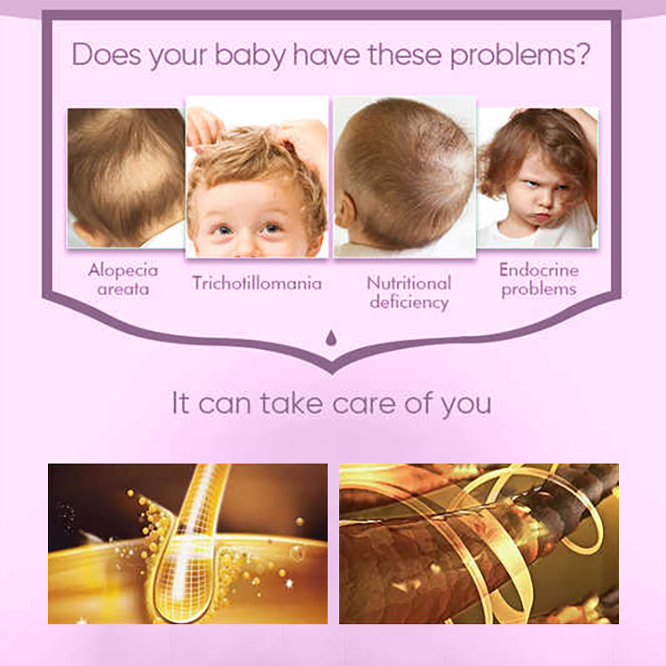 60ML Pineapple Kids Hair Growth Oil,oalen cosmetics