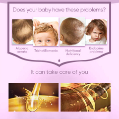 60ML Pineapple Kids Hair Growth Oil,oalen cosmetics