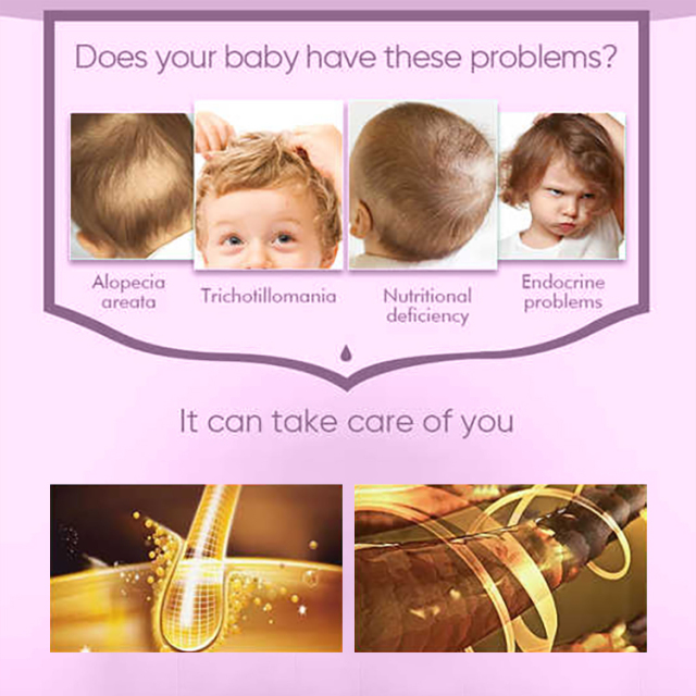 60ML Pineapple Kids Hair Growth Oil,oalen cosmetics