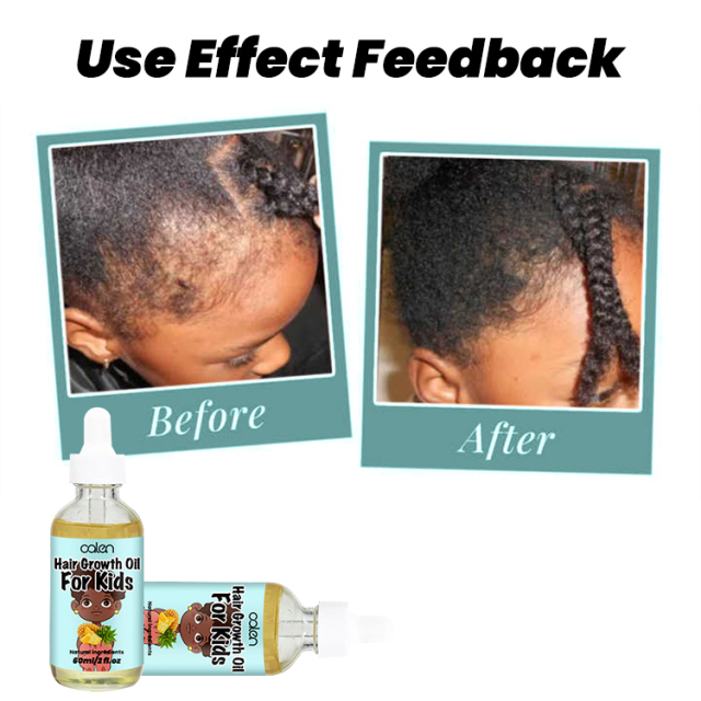 Dry Damaged Kids Hair Growth Oil,oalen cosmetics