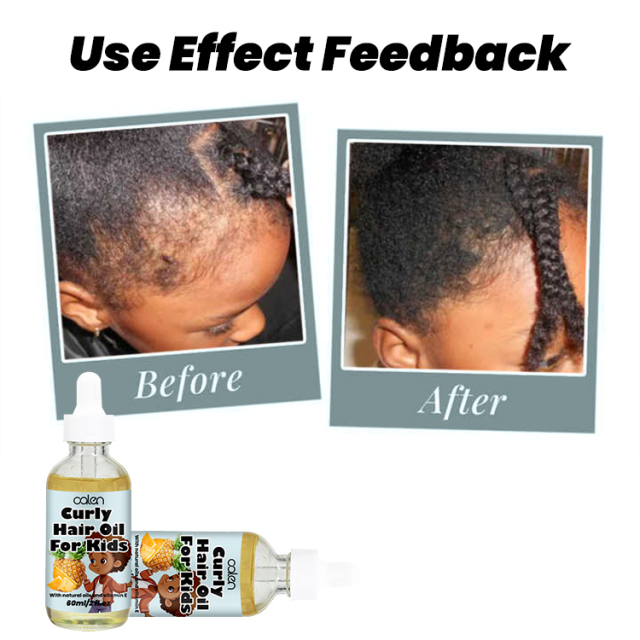 Scalp Nourishment 60ML Hair Oil For Kids,oalen cosmetics