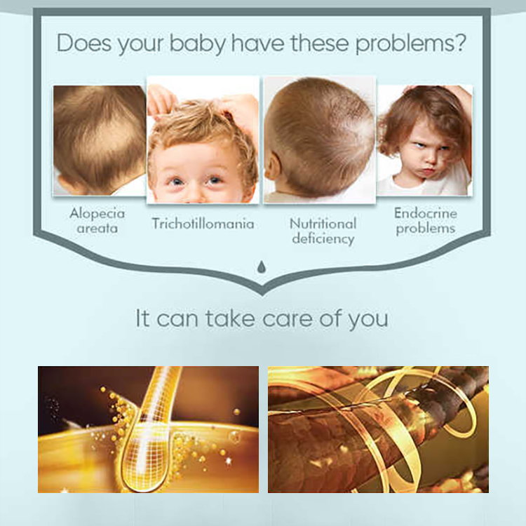 Scalp Nourishment 60ML Hair Oil For Kids,oalen cosmetics