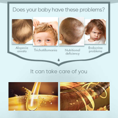 Scalp Nourishment 60ML Hair Oil For Kids,oalen cosmetics
