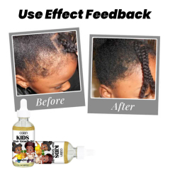 Organic Pineapple 60ML Hair Growth Oil,oalen cosmetics