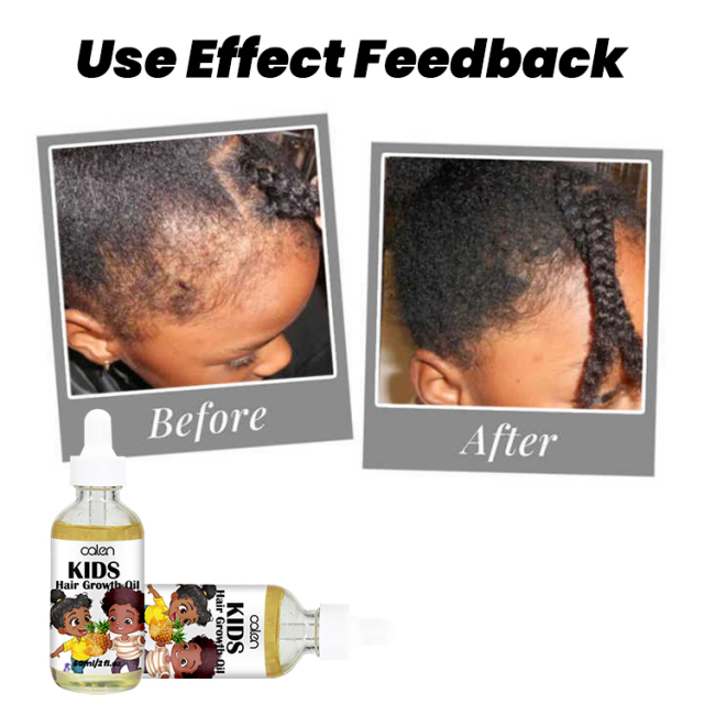 Organic Pineapple 60ML Hair Growth Oil,oalen cosmetics
