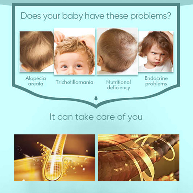 Dry Damaged Kids Hair Growth Oil,oalen cosmetics