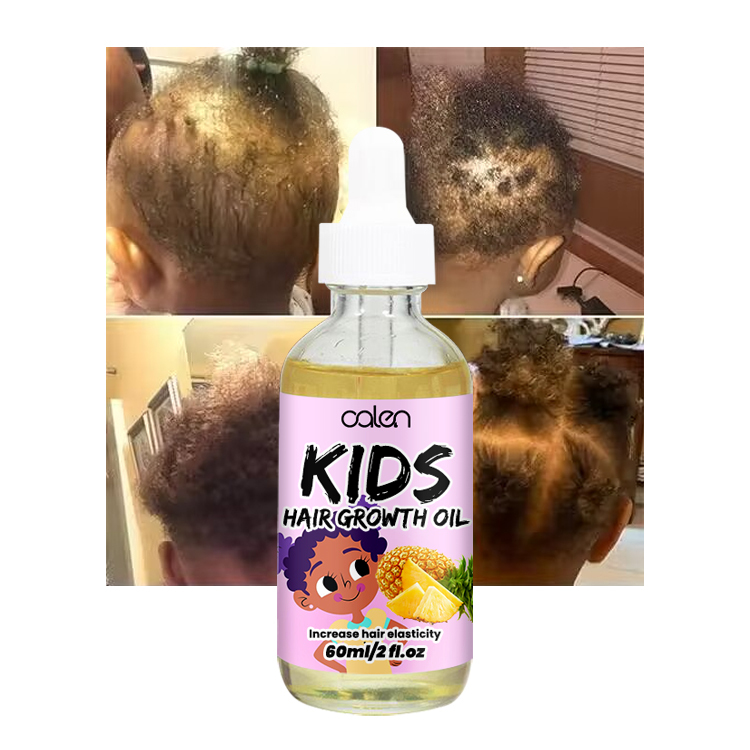 60ML Pineapple Kids Hair Growth Oil,oalen cosmetics