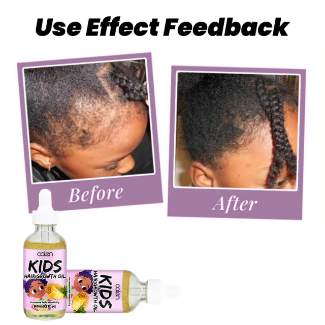 60ML Pineapple Kids Hair Growth Oil,oalen cosmetics