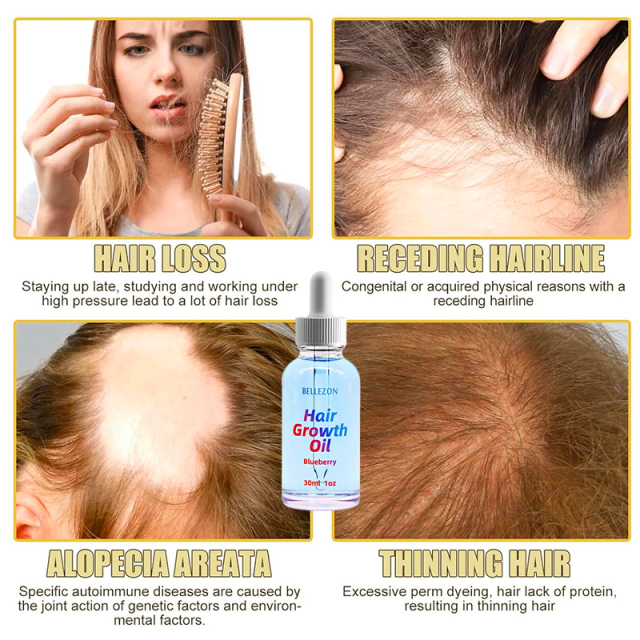 Oalen Private Label Extract Organic Hair Moisturizing And Growth Hair Oil,oalen cosmetics