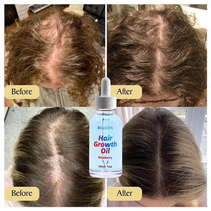 Oalen Private Label Extract Organic Hair Moisturizing And Growth Hair Oil,oalen cosmetics