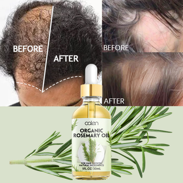 30ML Factory ODM OEM Improves Hair Texture Intensive Deep Treatment Rosemary Oil Hair,oalen cosmetics
