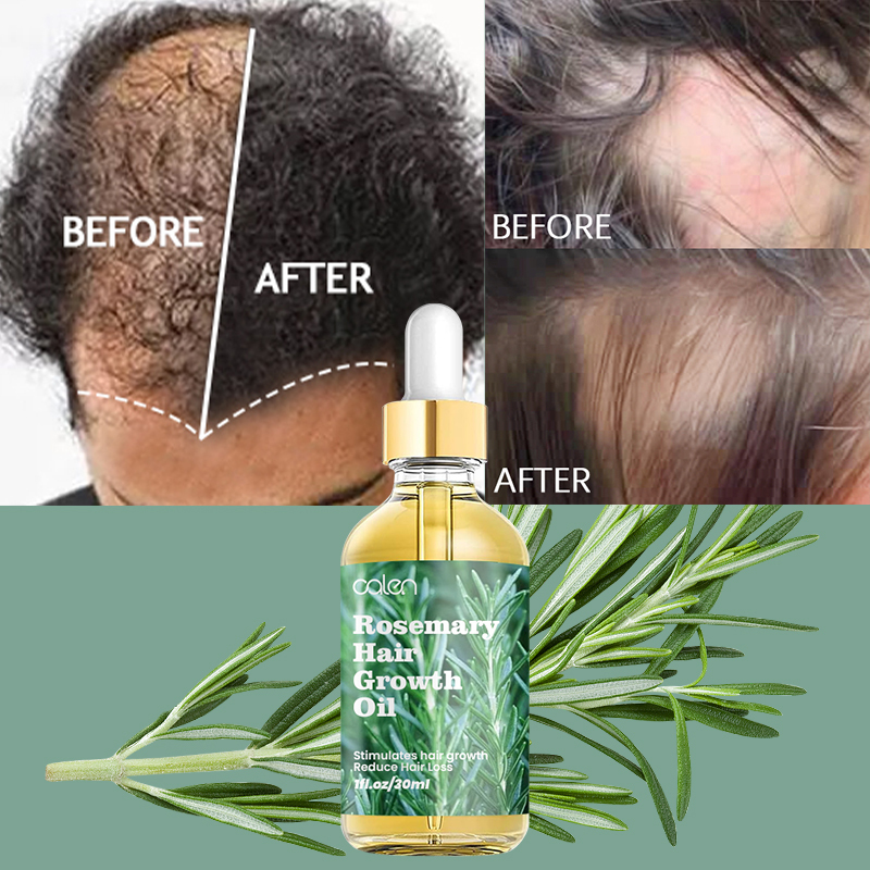Luxfume Private Label Natural Ingredients Promote Hair Growth Baby Suitable Rosemary Growth Hair,oalen cosmetics