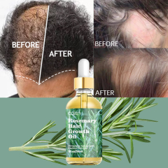 Luxfume Private Label Natural Ingredients Promote Hair Growth Baby Suitable Rosemary Growth Hair,oalen cosmetics