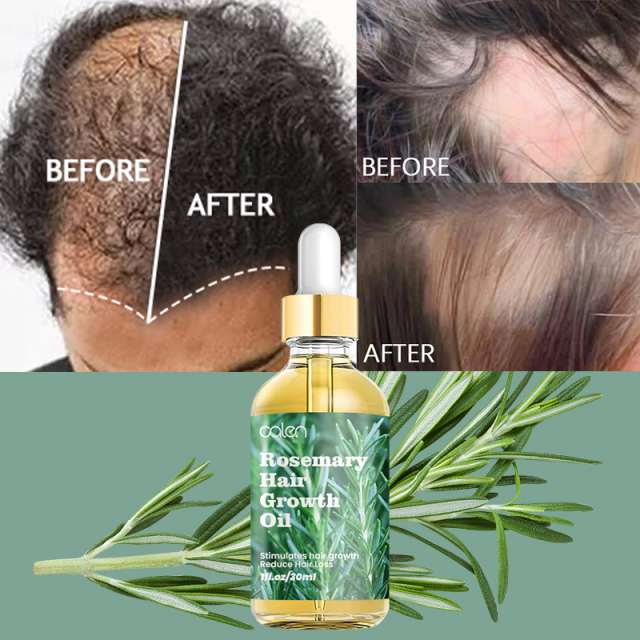 Luxfume Private Label Natural Ingredients Promote Hair Growth Baby Suitable Rosemary Growth Hair,oalen cosmetics