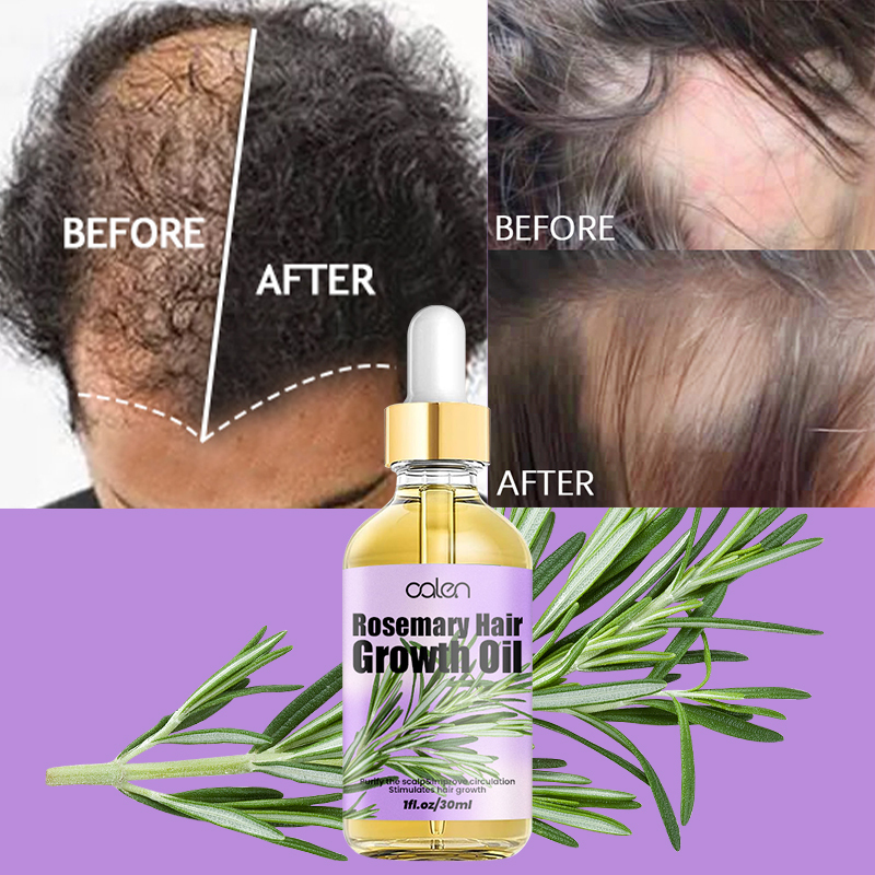 Luxfume High Quality Enhances Hair Elasticity Soothe Dry Scalp Hair Growth Rosemary Oil,oalen cosmetics