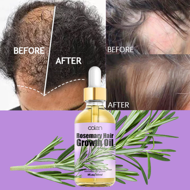 Luxfume High Quality Enhances Hair Elasticity Soothe Dry Scalp Hair Growth Rosemary Oil,oalen cosmetics