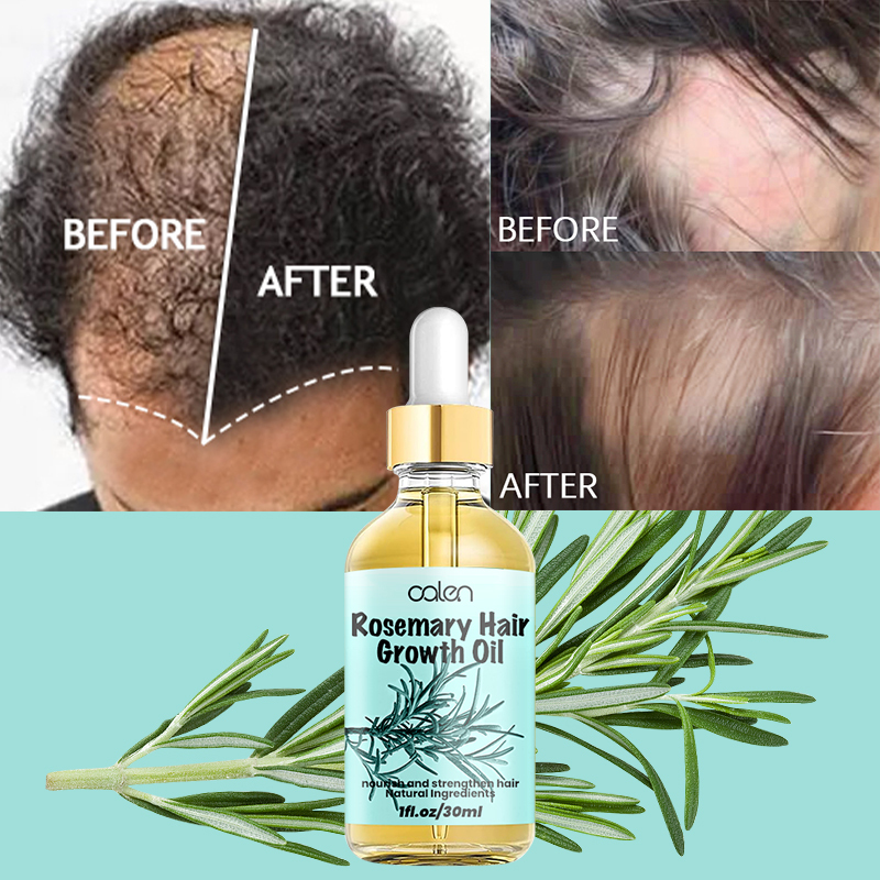 Luxfume 30ML Factory Improves Hair Texture Intensive Rosemary Oil Hair Growth,oalen cosmetics
