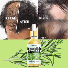 Oalen 30ML Factory ODM OEM Improves Hair Texture Intensive Deep Treatment Rosemary Oil,oalen cosmetics